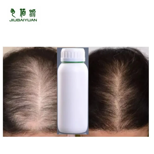 Minoxidil Liquid For Hair